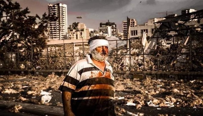 الرابع من آب.. حين توحّد اللبنانيون بجرحهم
